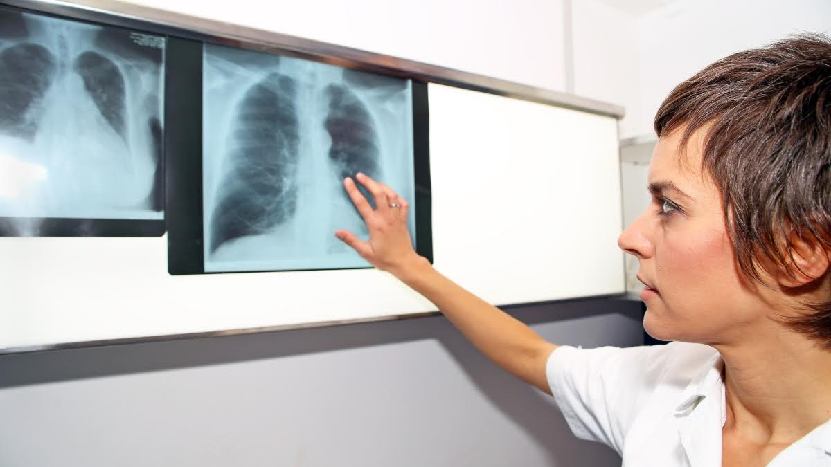 What Is Pulmonary Embolism